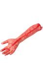 Afgehakte Arm