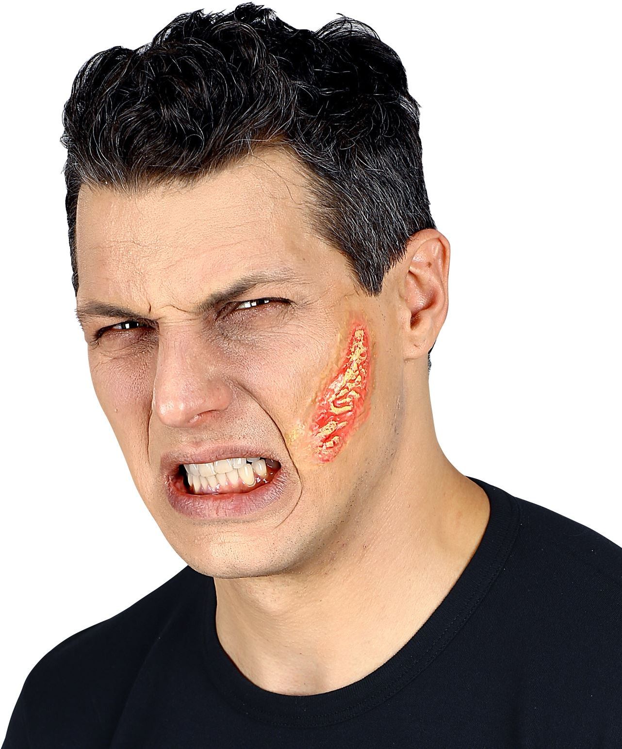 Opplakbare Brandwond